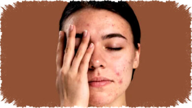 Atasi Jerawat dan Kulit Kusam Saat Menstruasi, Rahasia Perawatan Skincare yang Tak Banyak Diketahui